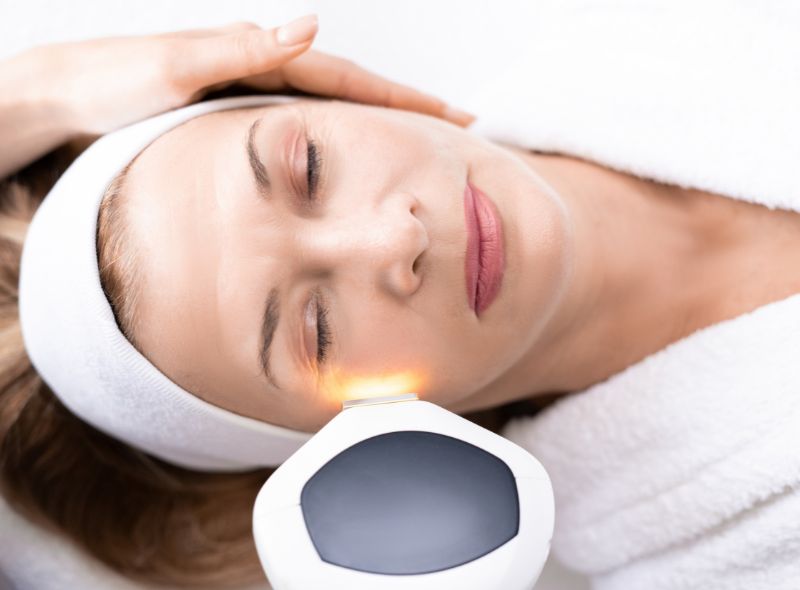 FOTOREJUVENECIMIENTO